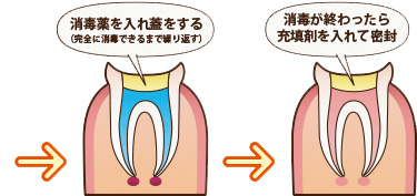 治療2